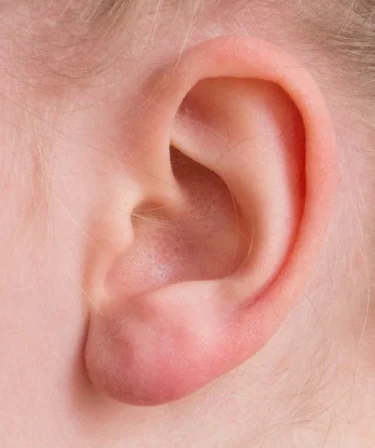 気圧の変化による体調不良は内耳が影響している！？天気痛を改善する２つの方法